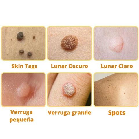 DermaBEE Manchas BeeLab
